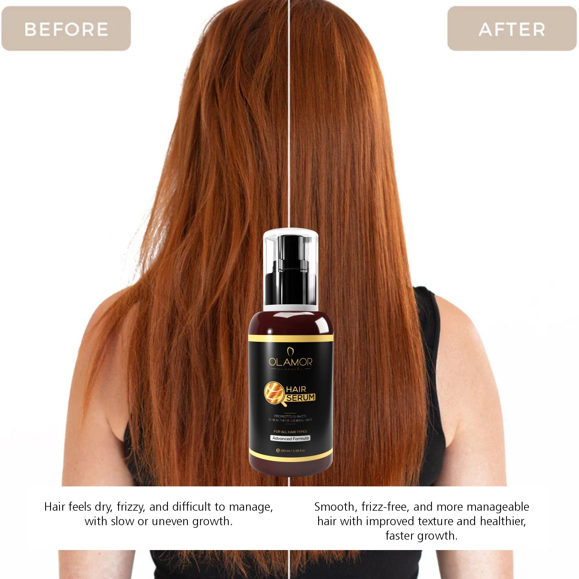 Vitamin-E Hair Serum with Macadamia Oil for Frizzy Hair & Healthier Hair Growth - 100ml