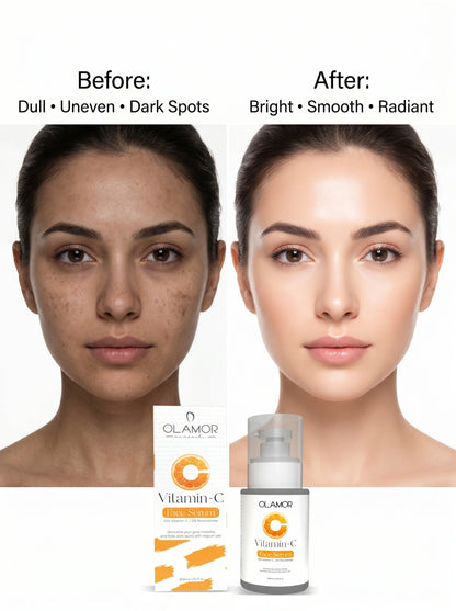 OLAMOR  Vitamin C Face Serum | Brightening &amp; Skin Tone Improving Serum for Glowing, Even &amp; Radiant Skin | For Men &amp; Women 30ml